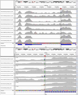A p53 transcriptional signature in primary and metastatic cancers derived using machine learning